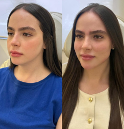 Full Face Feminino - Dra. Kamila Lobo